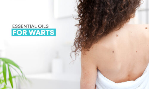 ESSENTIAL OILS FOR WARTS